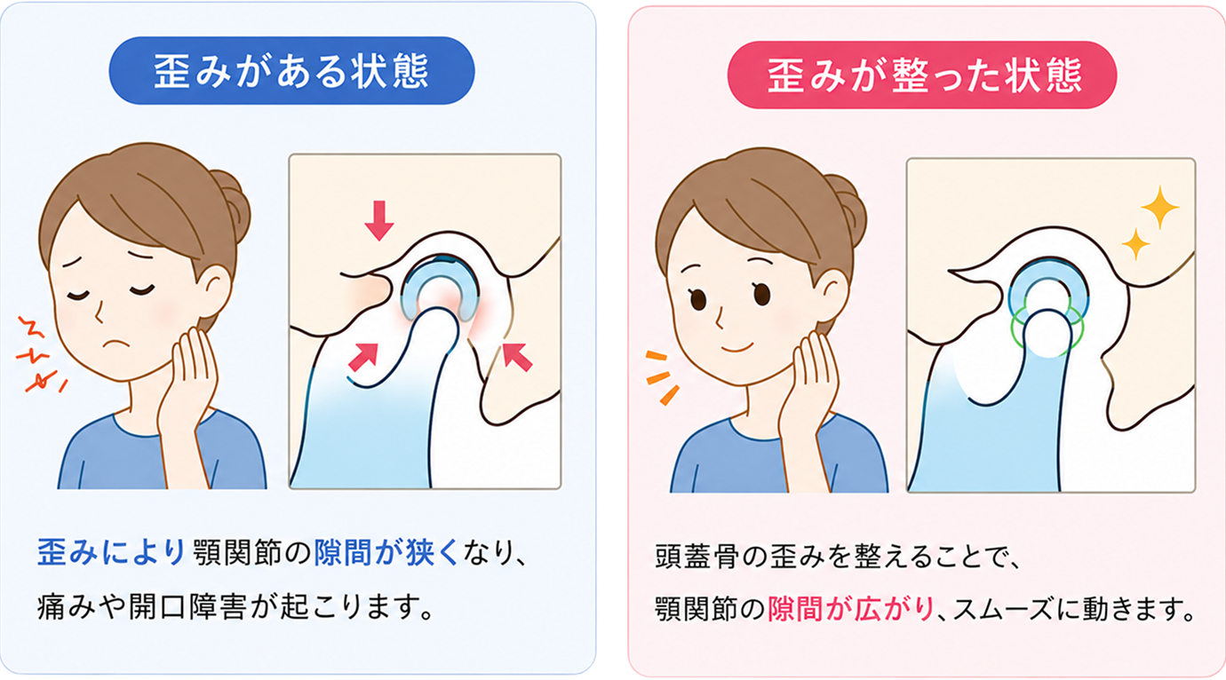 頭蓋骨調整の図解